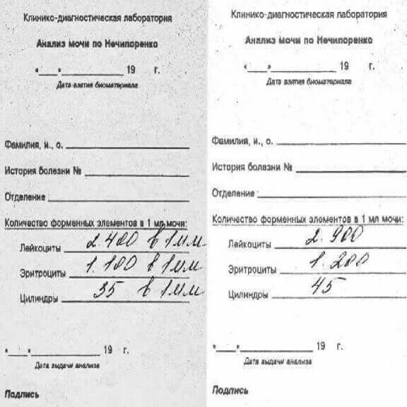 Купить Анализ мочи по Нечипоренко (форма 215/у)