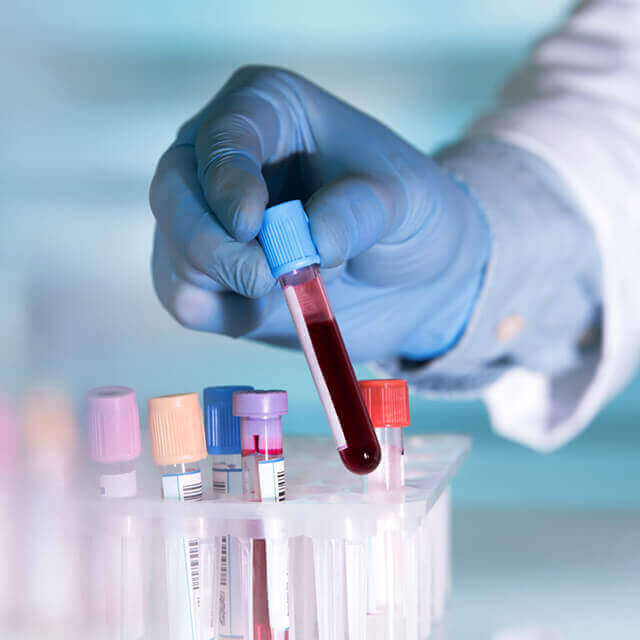 Купить справку с результатами анализа крови общего и биохимиии